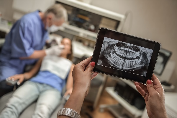 How Often Does A General Dentist Recommend X Rays?