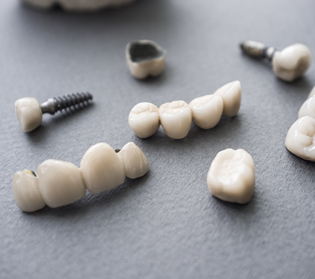 Lakewood The Difference Between Dental Implants and Mini Dental Implants