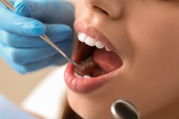 Should I Get An Oral Cancer Screening?