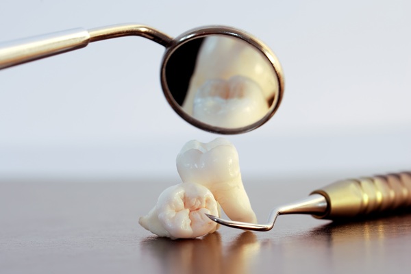 Dos And Don&#    ;ts Of Tooth Extraction Aftercare