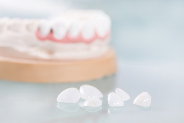 Can Dental Veneers Cover Imperfections On Teeth?